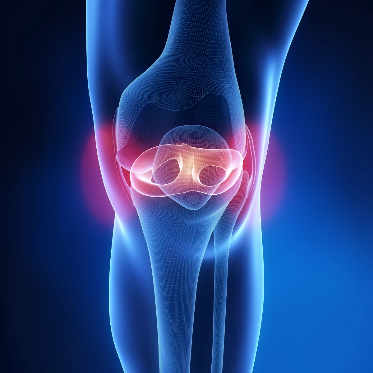 meniscus tear and repair kenya
