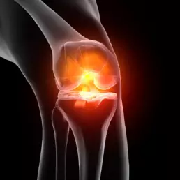 total knee replacement or partial knee replacement surgeries