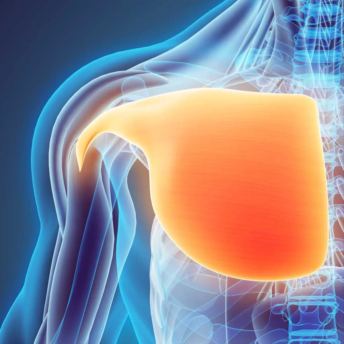 Pectoralis Major Injuries in Nairobi